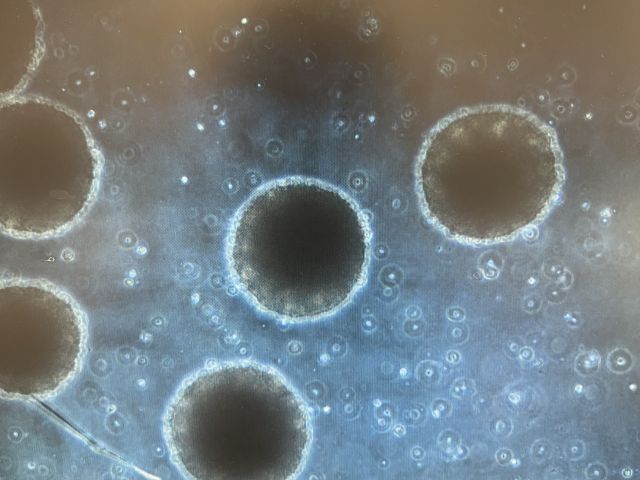 Embryo bodies (spheres of iPSCs)