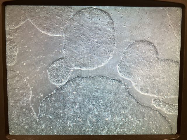 induced Pluripotent Stem Cell (iPSC) Colonies