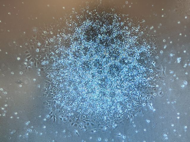 Plated embryo body pushed toward the neuronal lineage displaying neural rosettes