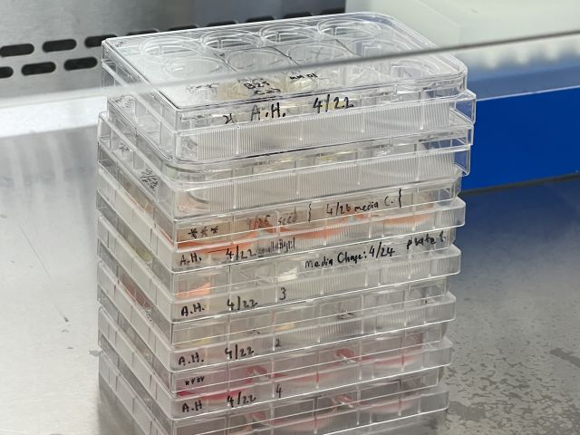 Many culture plates were used