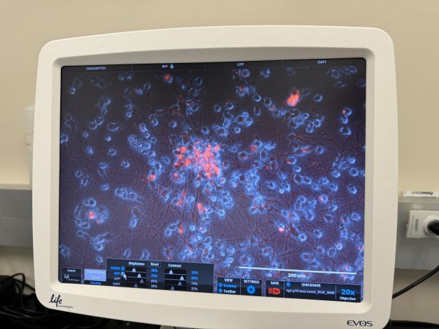 Microglia consuming fluorescent neurons